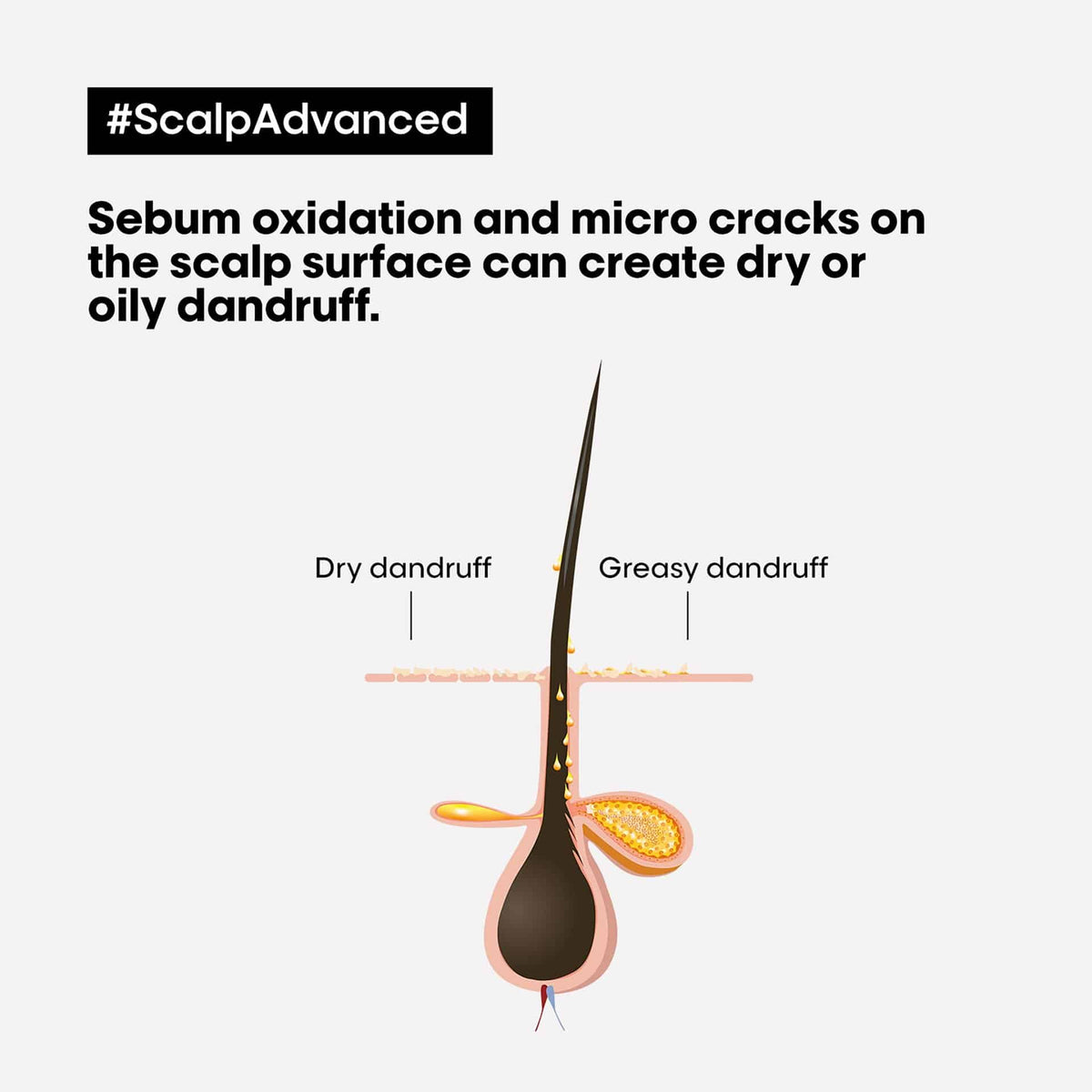 L'Oréal Professionnel Scalp Advanced Anti-Discomfort Shampoo 300ml