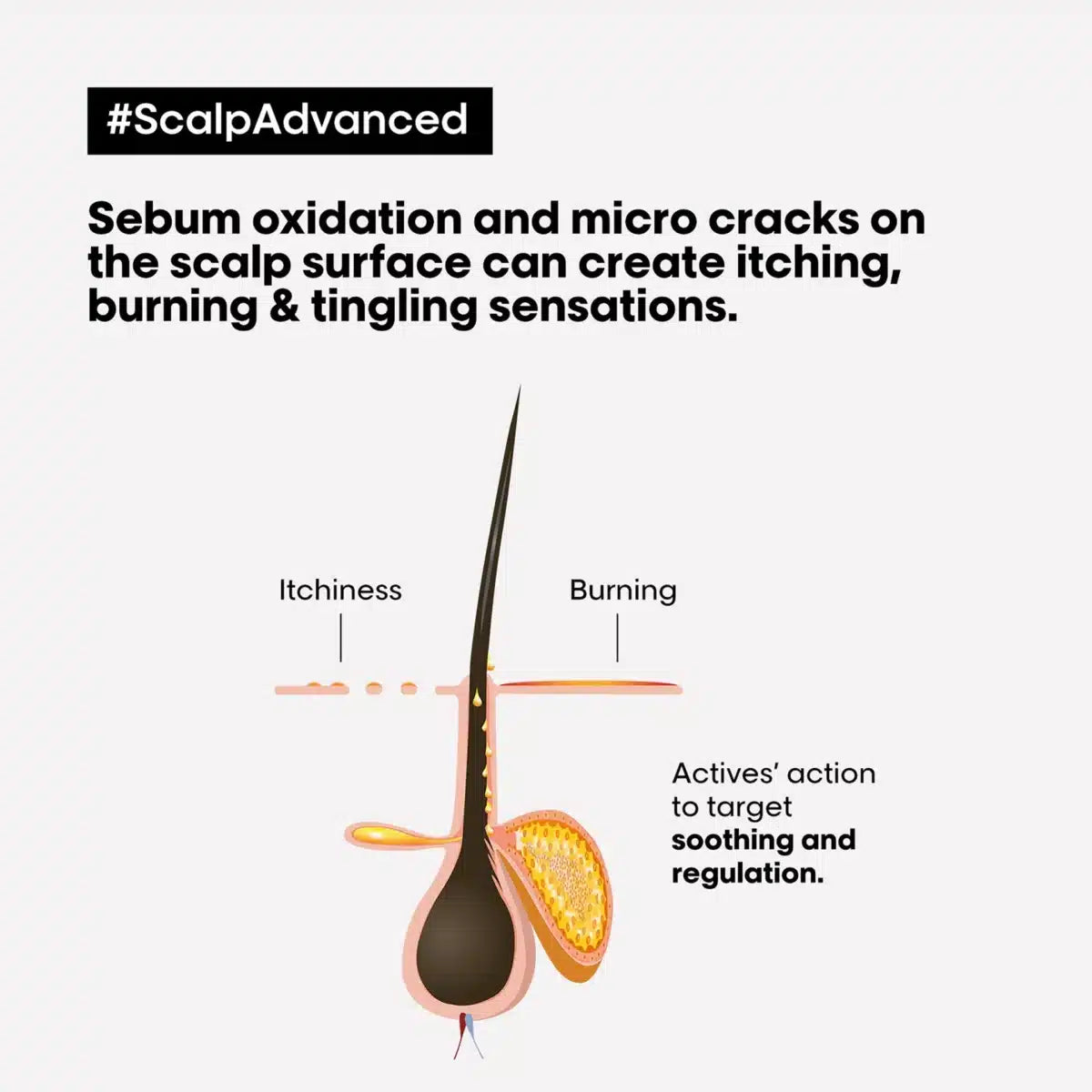 L'Oréal Professionnel Scalp Advanced Anti-Discomfort Intense Soother Treatment 200ml