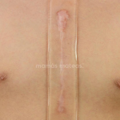 PIUR® Silicone Scar Sheet (Suitable for Cesarean Section)