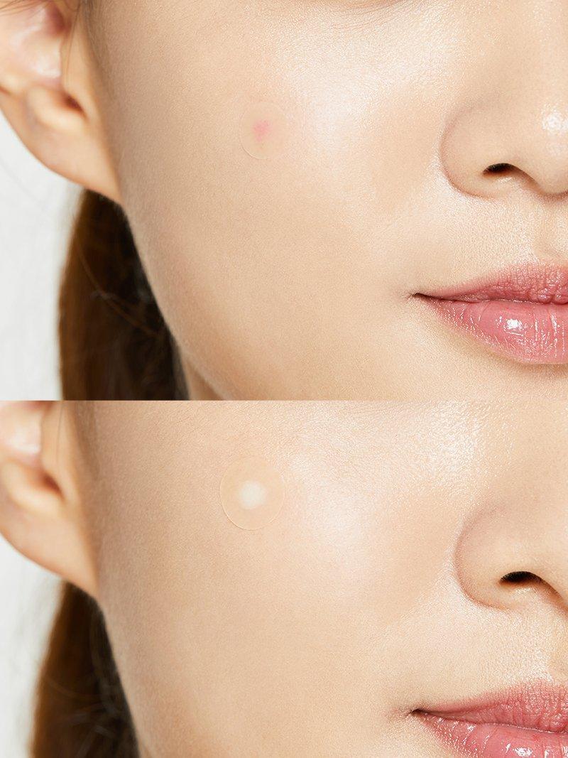 COSRX Acne Pimple Master Patch 24pcs
