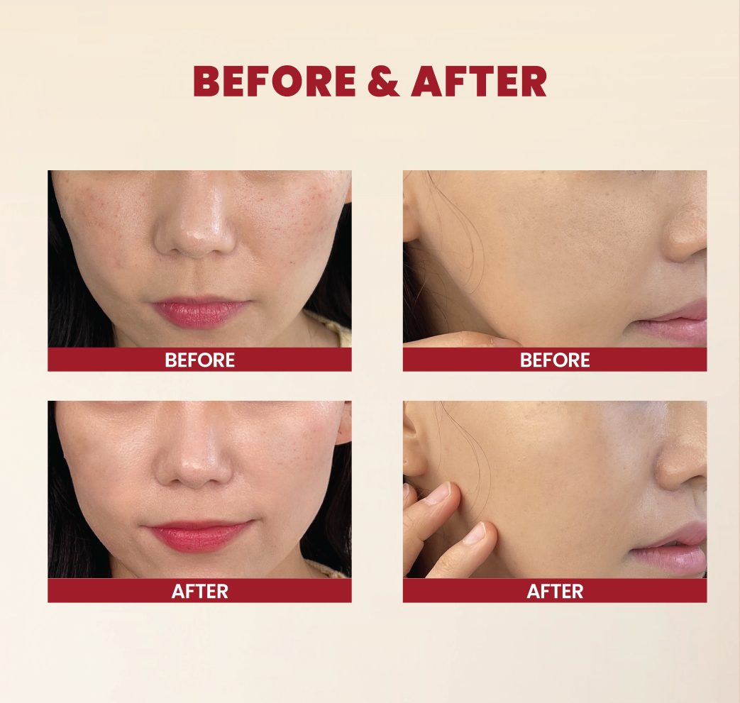 K SECRET SEOUL 1988  Cream Snail Mucin 93% + Rice 100ml