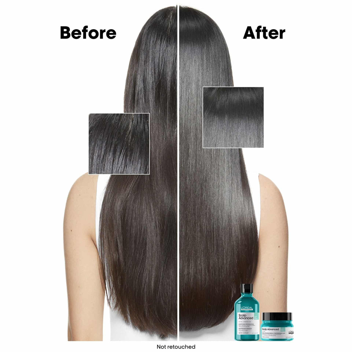 L'Oréal Professionnel Scalp Advanced Anti-Oiliness Shampoo 300ml