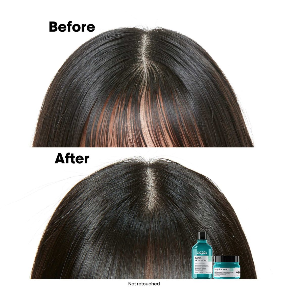 L'Oréal Professionnel Scalp Advanced Anti-Oiliness Shampoo 300ml